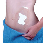 20435 Seal-Tight Shield Dressing Protector Pack of 5 (5"x8" / 3.5"x6" Coverage Area)