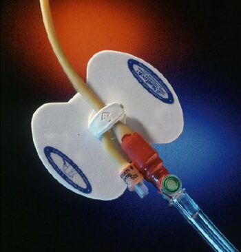 FOL0101 Foley Stabilization Device Statlock (RX)